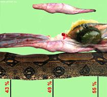 Stomach position Stomach position