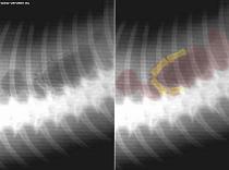 X-ray with prey remnant X-ray with prey remnant