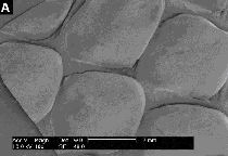 Epidermal_iridescence_/_Iriseren opperhuid Epidermal_iridescence_/_Iriseren opperhuid